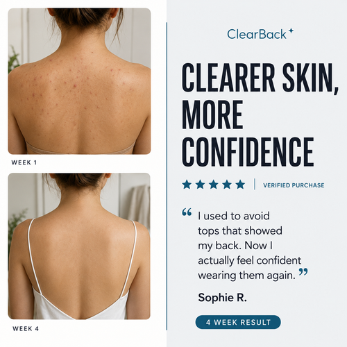 ClearBack Bar™ — Back & Body Acne Cleansing Bar